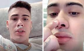 Em breve making of oficial! Mc Kevinho E Levado As Pressas Para Hospital Apos Acidente Nossa Fm 105 9 Ta Todo Mundo Ouvindo Patos De Minas Mg