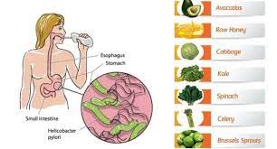 Stomach Ulcer And How To Avoid It — Steemit