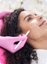 HArmonyCa Hybrid Filler Injections in Leeds, UK