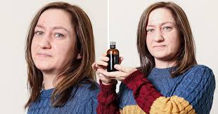 Woman says she can now leave the house thanks to CBD clearing her eczema