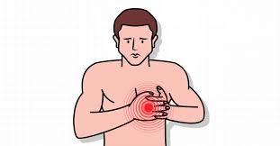 Image result for Chest Trauma