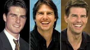 Here's what i've learned since my first cosmetic procedure 25 years ago. Tom Cruise Plastic Surgery Pictures Youtube