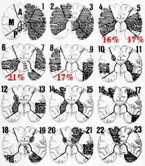 Shop by color, room type, theme or style. View Of Neuropathology Through The Ages Personal Reflections Free Neuropathology
