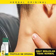 Who is at risk for fibroids? Jual Produk Obat Tumor Jinak Tumor Termurah Dan Terlengkap Februari 2021 Halaman 2 Bukalapak