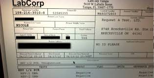 Herpes blood tests look for antibodies produced by the immune system in response to the herpes simplex virus. Nicole S Testimonial Pcr Test Results Negative Herpes Cure Youtube