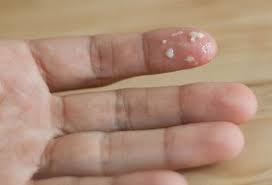 Cervical cancer occurs when abnormal cells develop and spread in the cervix, the lower part of the uterus. Vaginal Discharge Chart Some Important Facts All Women Must Know Theasianparent