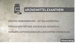 Check spelling or type a new query. Doktorweigl Erklart Arzneimittelexanthem Hautausschlag Nach Antibiotika Ursachen Und Therapie