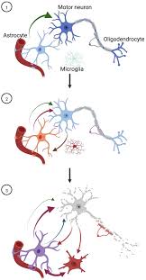 Astrocytes: Dissecting Their Diverse Roles in Amyotrophic Lateral Sclerosis  and Frontotemporal Dementia