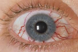 Image result for lesion sclera