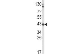 Free online english lesson activities for teaching and learning english words for high frequency signs and symbols. Product Overview Anti Adh5 Antibodies