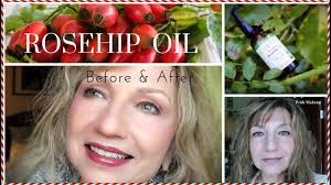 Rosehip Seed Oil