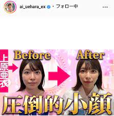 上原亜衣、顔の美容整形したビフォーアフターを公開！「圧倒的小顔」に激変し「超絶可愛い」「綺麗」 : スポーツ報知