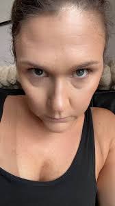 Honestly, These bags and circles and doing my head in! I have tried soooo  many things for both the discoloration and the puffiness but nothing has  worked! I am not getting a