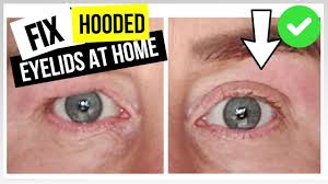 Check spelling or type a new query. How To Get Rid Of Hooded Eyelids Home Eyelid Tightening Youtube