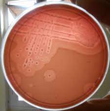 We did not find results for: Double Zone Of Hemolysis Produced By Clostridium Perfringens On Sheep Download Scientific Diagram