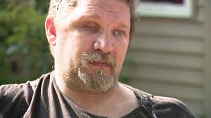 Fundraiser to be held for Taylor man shot in the head by burglar