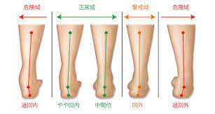 足底筋膜炎とは 原因と治療法 ストレッチやテーピングの全知識 足底筋膜炎 エクササイズメニュー 筋膜