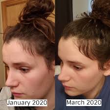 Avoid using mineral oil on your hair. Combat Hair Thinning Or Loss Of Density Monat Hair Thicken Hair Naturally Anti Aging Hair