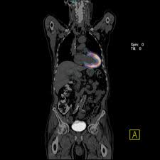 Start a quote for pet insurance and see how affordable a policy for your dog or cat can be! What Is Positron Emission Tomography Pet Imaging Daic