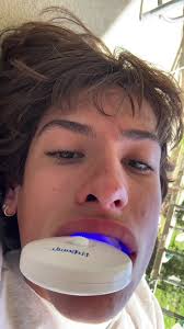 How i get my teeth to get so white 👇🏻