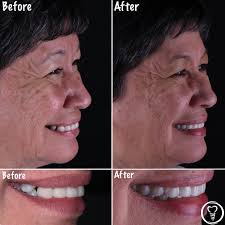 Family, Implant & Cosmetic Dentistry