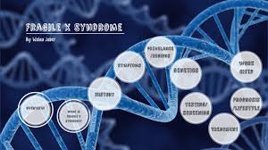Fragile X Syndrome By Walaa