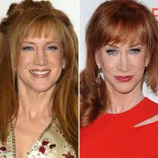 Opinions and recommended stories about kathy griffin. Has Kathy Griffin Gotten Plastic Surgery We Ve Got The Answer