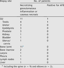Image result for Genitourinary Tuberculosis