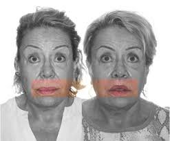 Dr. Joan Ramon Garces Gatnau