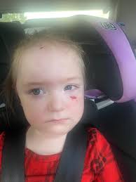 BYC (BackYardChickens)