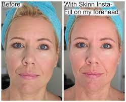 Best Instant Wrinkle Removers Huge Makeup Giveaway Wrinkle Remover Face Care Wrinkles Wrinkled Skin