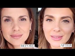 How I Got Rid Of Under Eye Hollows And Improved My Overall Look Ali Andreea Youtube Under Eye Hollows Sunken Eyes Under Eye Primer