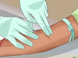 Sie entstehen immer erst, wenn sich das virus stark genug vermehrt hat. Hiv Symptome Erkennen Wikihow