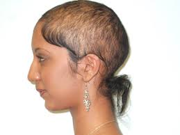 Getting a chunky, textured, and short cut can add volume and camouflage your scalp. How To Hide Thinning Hair Hair Loss Wigs Thin Hair Balding Scalp