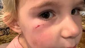 Mamá sacrifica al gallo que molestó a su hija y lo hace nuggets