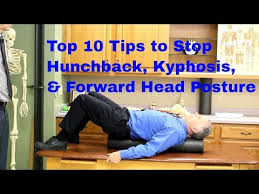 Top 10 Exercises To Stop Hunchback Kyphosis Forward Head Posture Youtube Forward Head Posture Posture Correction Exercises Forward Head Posture Correction