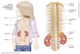 3 ﻿ so how do you know if your child has one of these cancers? View All Pages Cancer Net