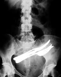 Read on for some hilarious trivia questions that will make your brain and your funny bone work overtime. 7 Xrays For Quiz Ideas X Ray Bizarre Radiology