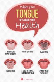 Pin On Health And Wellness