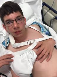 7 year old boy breaks arm in two places after falling from monkey bars