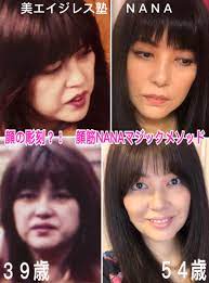 美容整形なしで自力で見た目年齢を逆行 ナチュラルエイジングビューティー 有名人の整形手術 美容整形 顔のエクササイズ