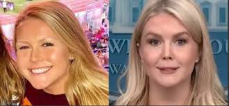 Critic shares before-and-after photos of Karoline Leavitt, sparking  speculation about possible cosmetic surgery.