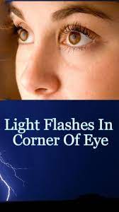 Flashes Of Light In Corner Of Eye In 2021 Flashes In Eye Eyes Eye Care