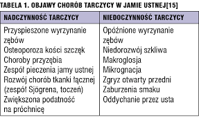 Nadczynność tarczycy występuje u pacjentów ze zwiększoną ilością produkowanych hormonów tarczycy. Medical Tribune Stomatologia Choroby Gruczolu Tarczowego A Zdrowie Jamy Ustnej