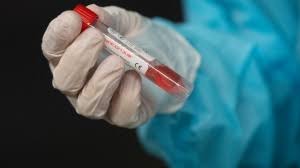 If there is a discrepancy between numbers reported here and those reported publicly by a public health unit, it is likely because the public health unit hasn't yet updated their numbers in ccm. Ontario Reports Record Number Of New Coronavirus Cases For Second Consecutive Day Cp24 Com