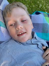 Aloe Propolis creme alla dar i veckan. Hör av dig om du vill testa.