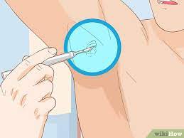 We did not find results for: 3 Simple Ways To Get Rid Of Boil Scars Wikihow