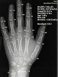 Want to learn this set quickly? Artificial Intelligence In Healthcare Wikipedia