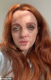 Mother reveals she was left a 'shadow of herself' by a narcissist ex