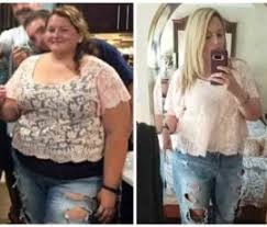 She lost over 100 pounds! 8 Common Problems After Weight Loss Surgery Prime Surgicare